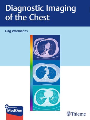 cover image of Diagnostic Imaging of the Chest